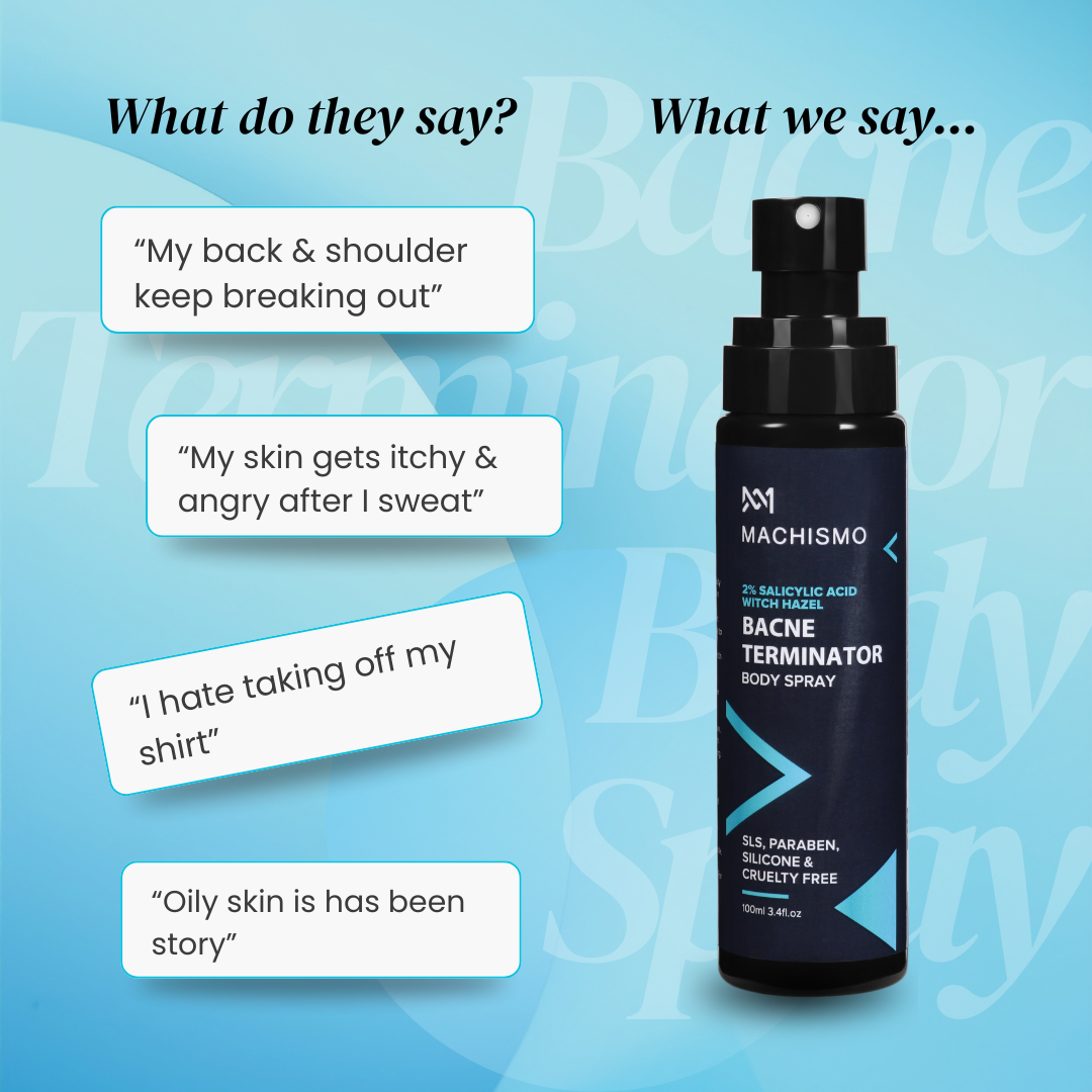 BACNE TERMINATOR BODY SPRAY WITH SALICYLIC ACID & WITCH HAZEL