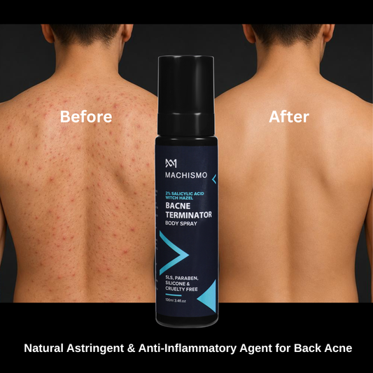 BACNE TERMINATOR BODY SPRAY WITH SALICYLIC ACID & WITCH HAZEL