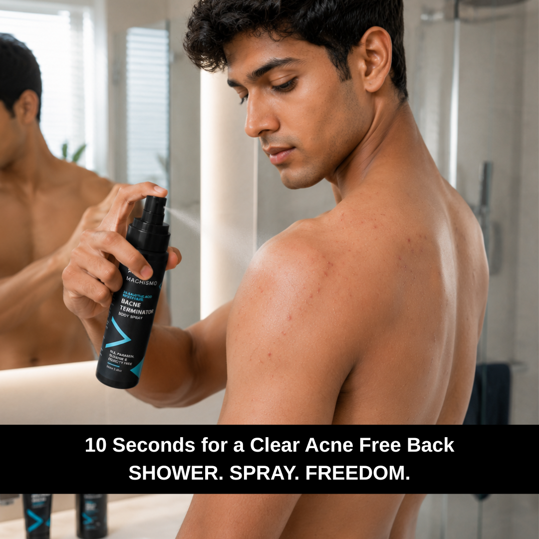 BACNE TERMINATOR BODY SPRAY WITH SALICYLIC ACID & WITCH HAZEL