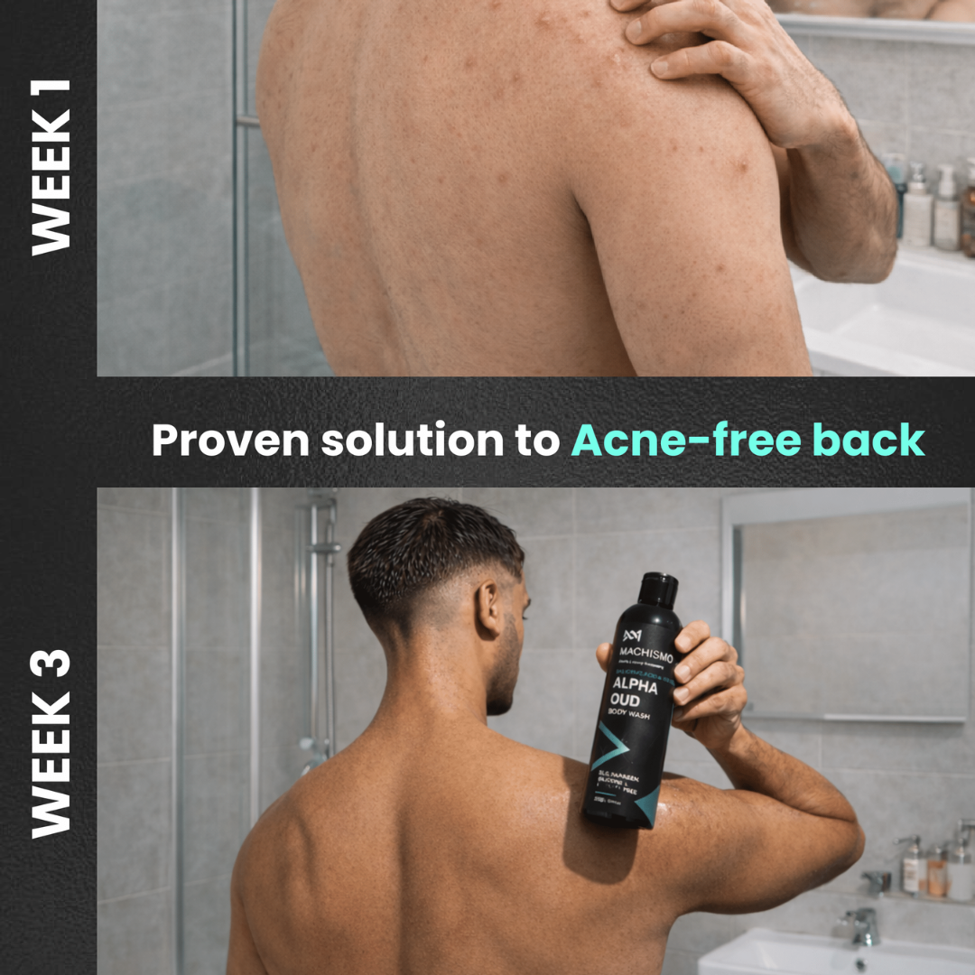 BACNE TERMINATOR BODY WASH WITH 2% SALICYLIC ACID